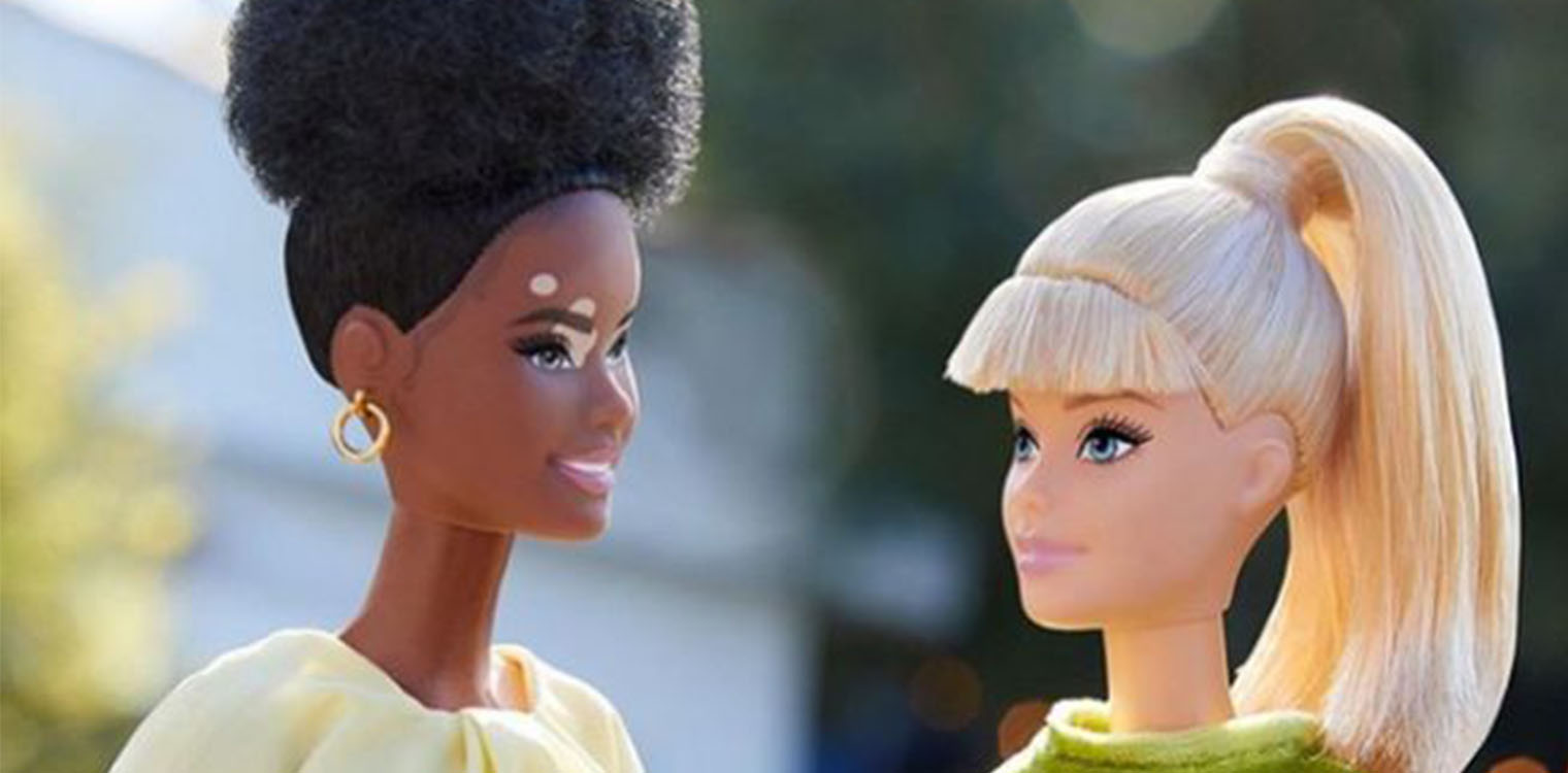 Η νέα κολεξιόν της Barbie λανσάρει κούκλες χωρίς μαλλιά, με λεύκη και προσθετικά μέλη