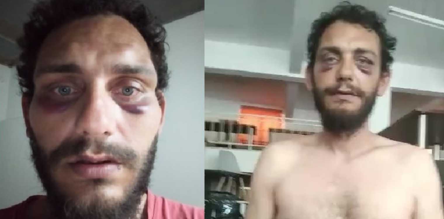 Κρητικός καταγγέλλει άγριο ξυλοδαρμό από αστυνομικούς επειδή νόμιζαν ότι είναι Πακιστανός
