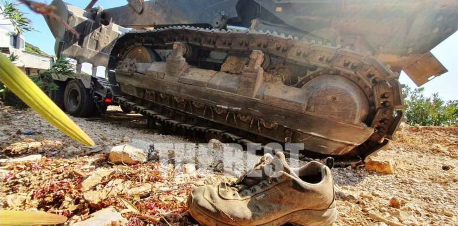 Στο χειρουργείο με συντριπτικό κάταγμα στο πόδι ο άτυχος χειριστής στη φωτιά στην Άνω Καλλιθέα (upd)