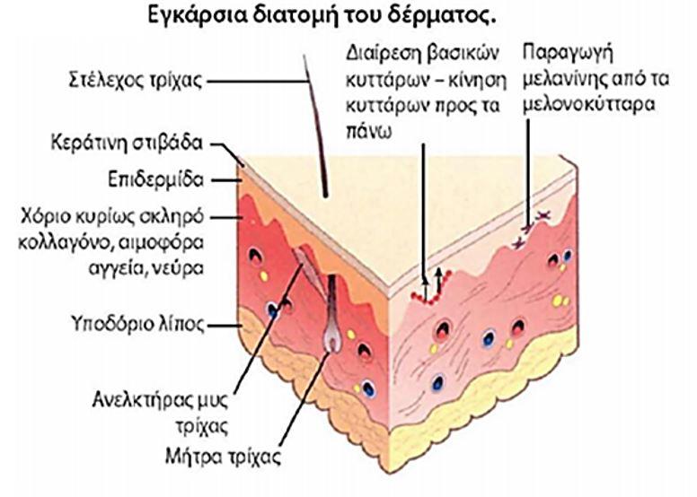 melanoma1