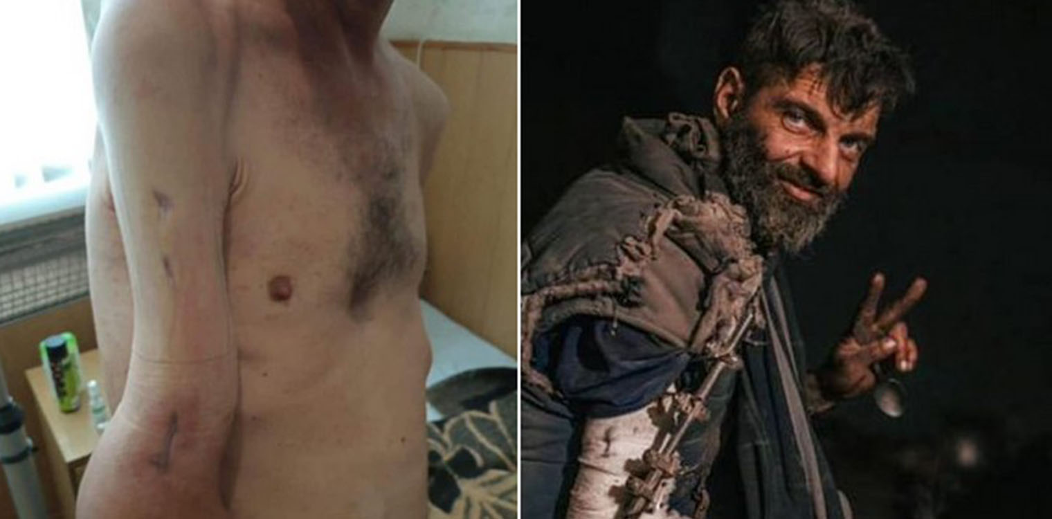 Ουκρανός αιχμάλωτος πολέμου περιγράφει βασανιστήρια στα χέρια των Ρώσων- «Μας αντιμετώπιζαν σαν ζώα»