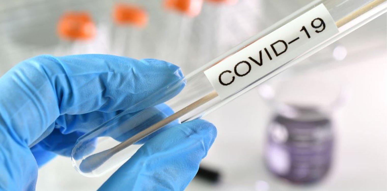 Δήμος Αρχ. Ολυμπίας: Ράπιντ τεστ Covid-19 την Τετάρτη 28 Ιουνίου στην Αρχ. Ολυμπία