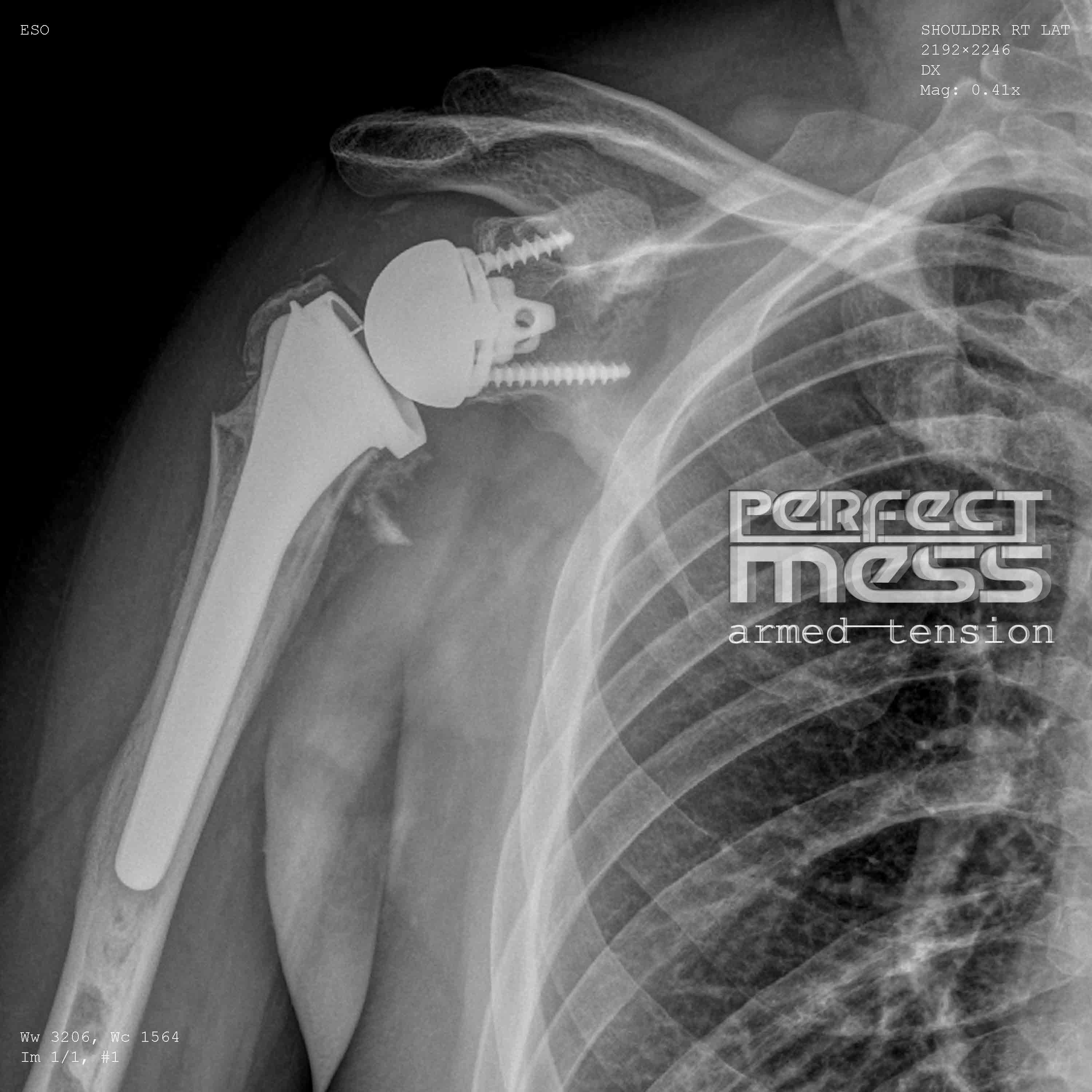 Perfect Mess album 2