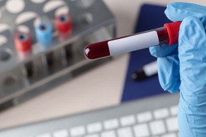 Νόσος Αλτσχάιμερ: Διαθέσιμη στην Ελλάδα η πρώτη εξέταση αίματος που αποκλείει την παρουσία της