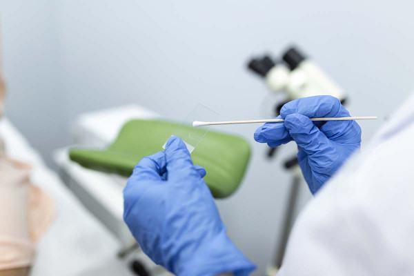 Δωρεάν τεστ Παπανικολάου και HPV DNA test στον Δήμο Αρχαίας Ολυμπίας