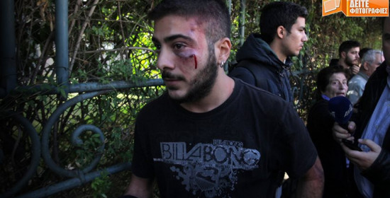 Φοιτητής τραυματίστηκε σε συμπλοκές με τα ΜΑΤ στο Πανεπιστήμιο Αθηνών